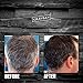 Verseo Anti-Gray Hair Coloring Treatment – Fast and Effective Improved Hair Coloring Formula – Usable as a Hair or Beard Treatment, 8 FL OZ(237 mL)