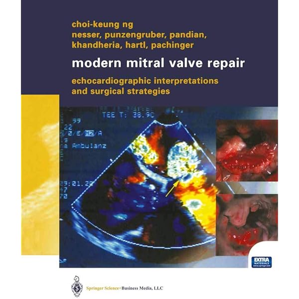 Carpentier's Reconstructive Valve Surgery: 9780721691688: Medicine
