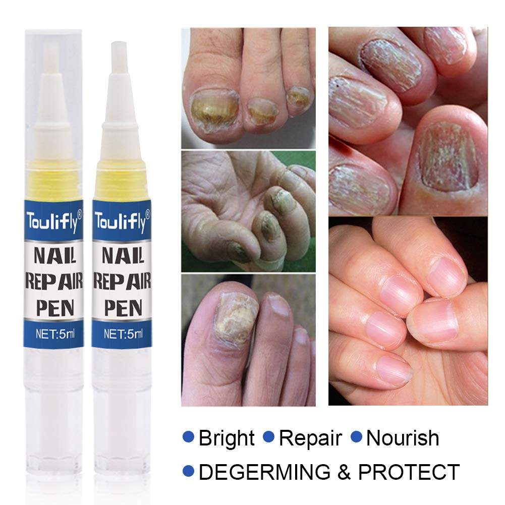Nail Repair, Nail Repair Pen, Nail Solution, Natural Nail Treatment, Effective Against Nail Infection Restores Discolored & Damaged Nails 4pc : Beauty
