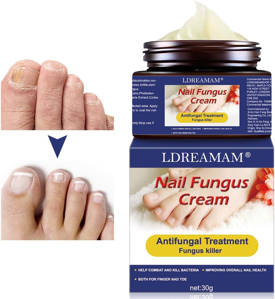 crema fungina per unghie dei piedi
