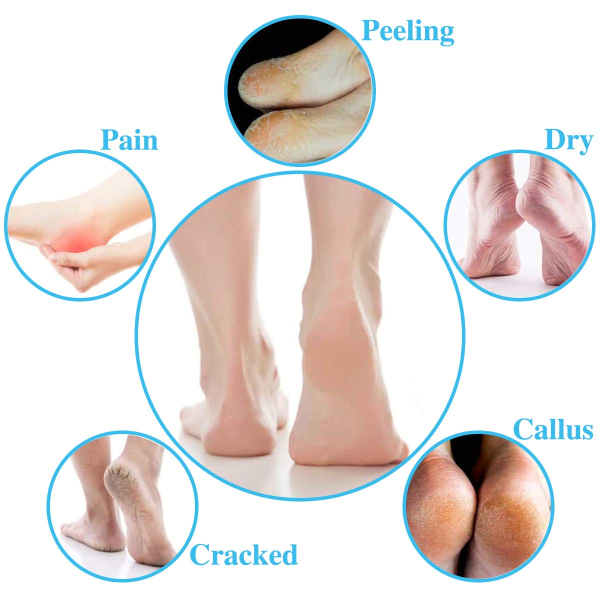 CABAX Heel Moisturizing Socks Open Toe Socks Cracked Gel Heel Socks Foot Toeless Cooling Heel Repair Socks for Women Dry Hard Cracked Feet, 4 Pairs : Beauty