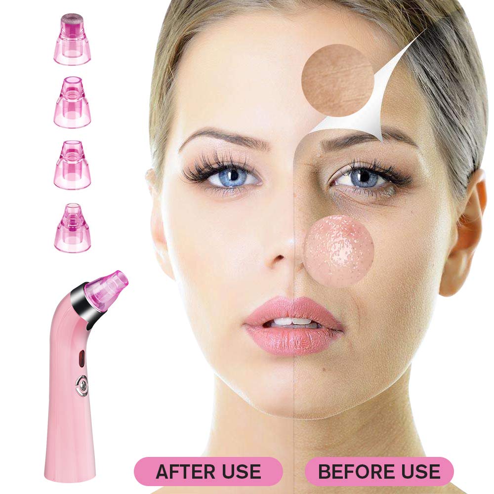 Kaufam Blackhead Remover Pore Vacuum USB Rechargeable Blackhead Suction Device Blemish Removal Tool for Women: Beauty