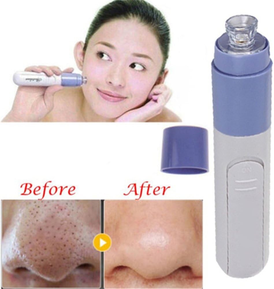 Mini Electric Facial Pore Blackhead Cleanser Skin Cleaner Face Dirt Suck Up Vacuum Tool