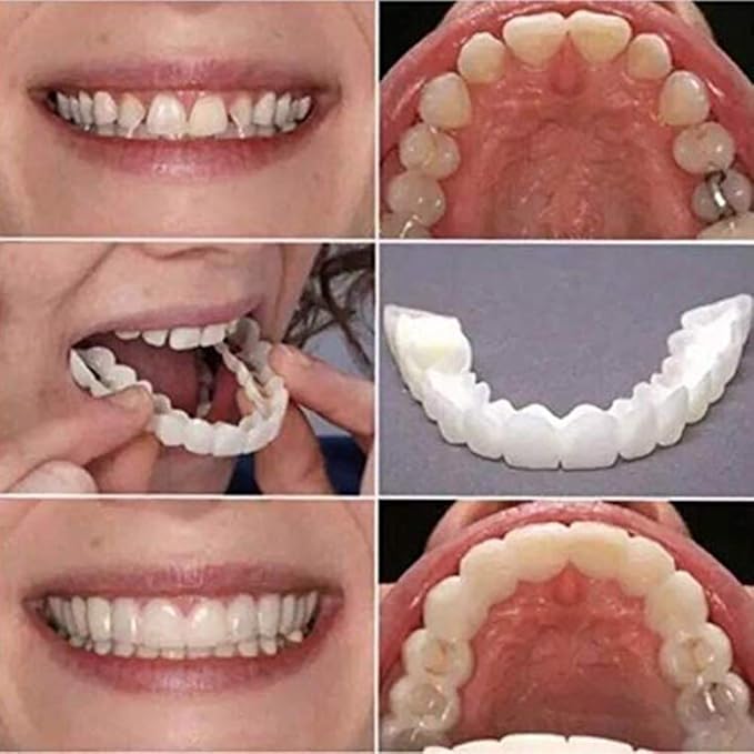 Dentier Amovible Amazon  . Une Prothèse Amovible Est Une Prothèse Qui Peut S�enlever.