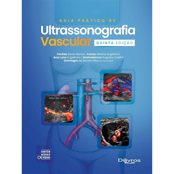ATLAS DE ECOGRAFIA VASCULAR DO DEPT DE IMAGEM CARDIOVASCULAR DIC