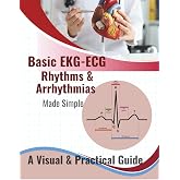 Basic EKG-ECG, Rhythms &amp; Arrhythmias Made Simple: A Beginner-Friendly Visual Guide to Understanding Heart Rhythms, Arrhythmias, and ECG Interpretation ... Paramedics, EMTs, and Medical Students