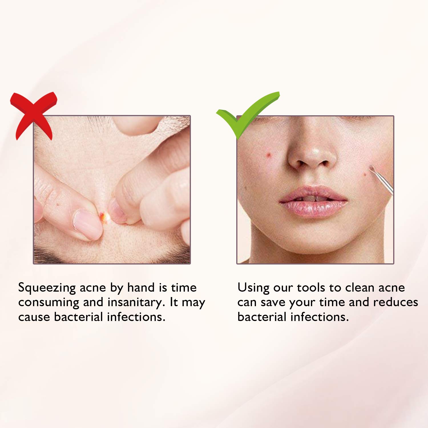 LUBEAU Blackhead Remover Tool Pimple Popper Acne Pimple Comedone Extractor Spot Remover Tool for Whitehead Blemish Zit, Facial Care Skin Protect with Leather Case and Mirror (6 pcs)