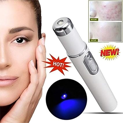 Yaogroo 2018 Spider vein Radiergummi-mächtige Anti-Varicose Venen Entfernungs Stift