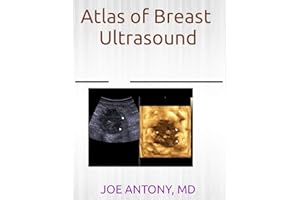 Atlas of breast ultrasound