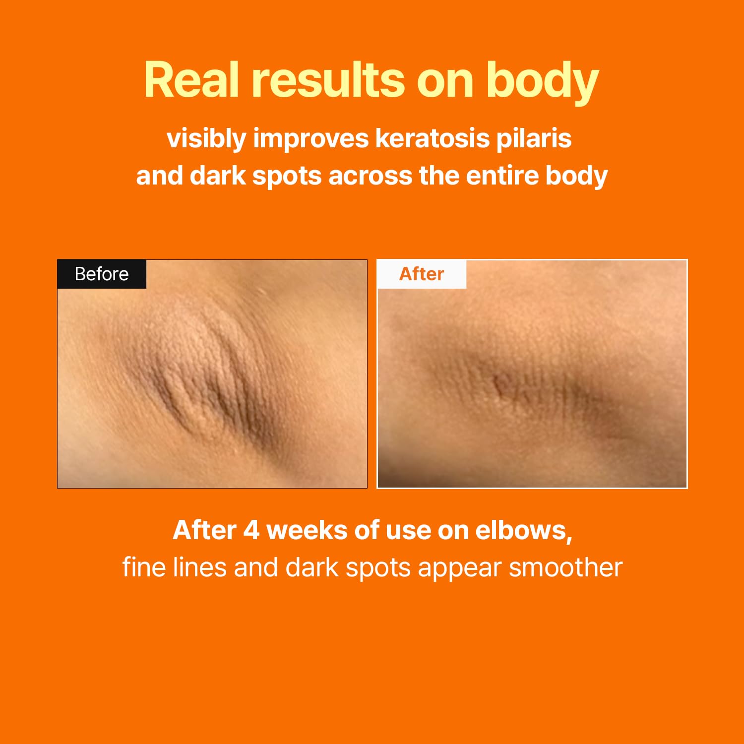 MEDITHERAPY Retinal Skin Booster Serum – Beginner-Friendly, Anti-Aging, Non-Irritating Retinol for Face and Body – Pore Minimizer, Wrinkle Treatment – Korean Skin Care, 5.07 Fl. Oz Large Size