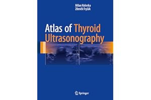 Atlas of Thyroid Ultrasonography