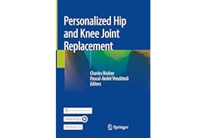 Personalized Hip and Knee Joint Replacement
