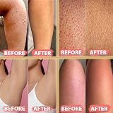 Kelebek Kese Turkish Hammam Exfoliating Glove Skin Spa Mitt view 9