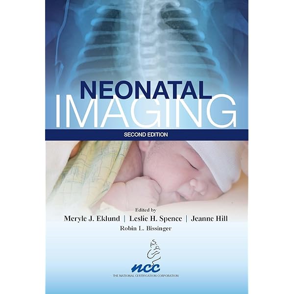 Amazon.com: Handbook of Neonatal Neurology, 1st edition