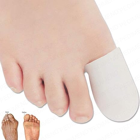 correcting soft corns