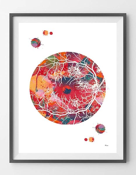 Amazon Co Jp Malertaart レティナアートプリント 目の解剖学ポスター 眼科 イラスト オプティックディスクとretinal Blood Vessels Ophthalmology Clinic Decor フレーム入り壁アート ホーム キッチン