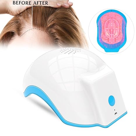 Buy Walfou Hair Growth Helmet 100 240v Hair Loss Regrowth