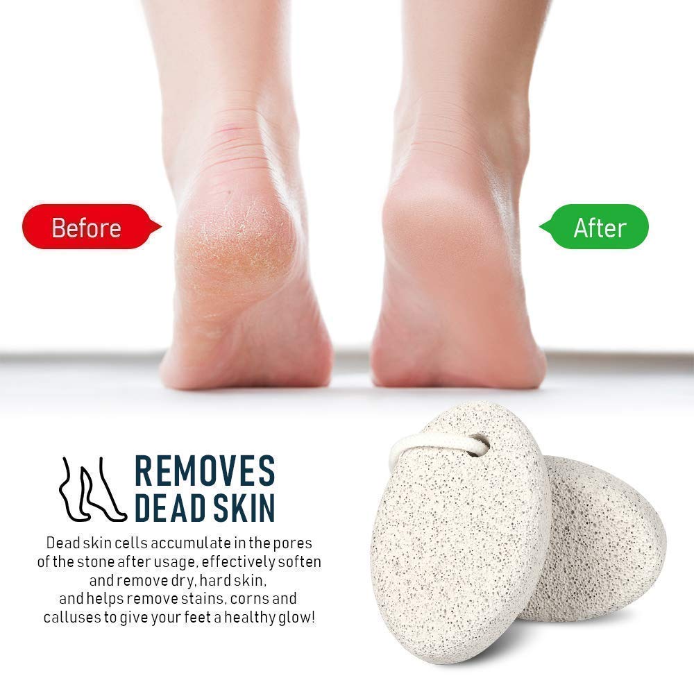 ZECLIN Natural Pumice Stone for Foot Callus - Premium Callus Remover for Feet and Hands - Pedicure Tools, Exfoliation to Remove Dead Skin - Natural Foot File (2 Pcs): Beauty