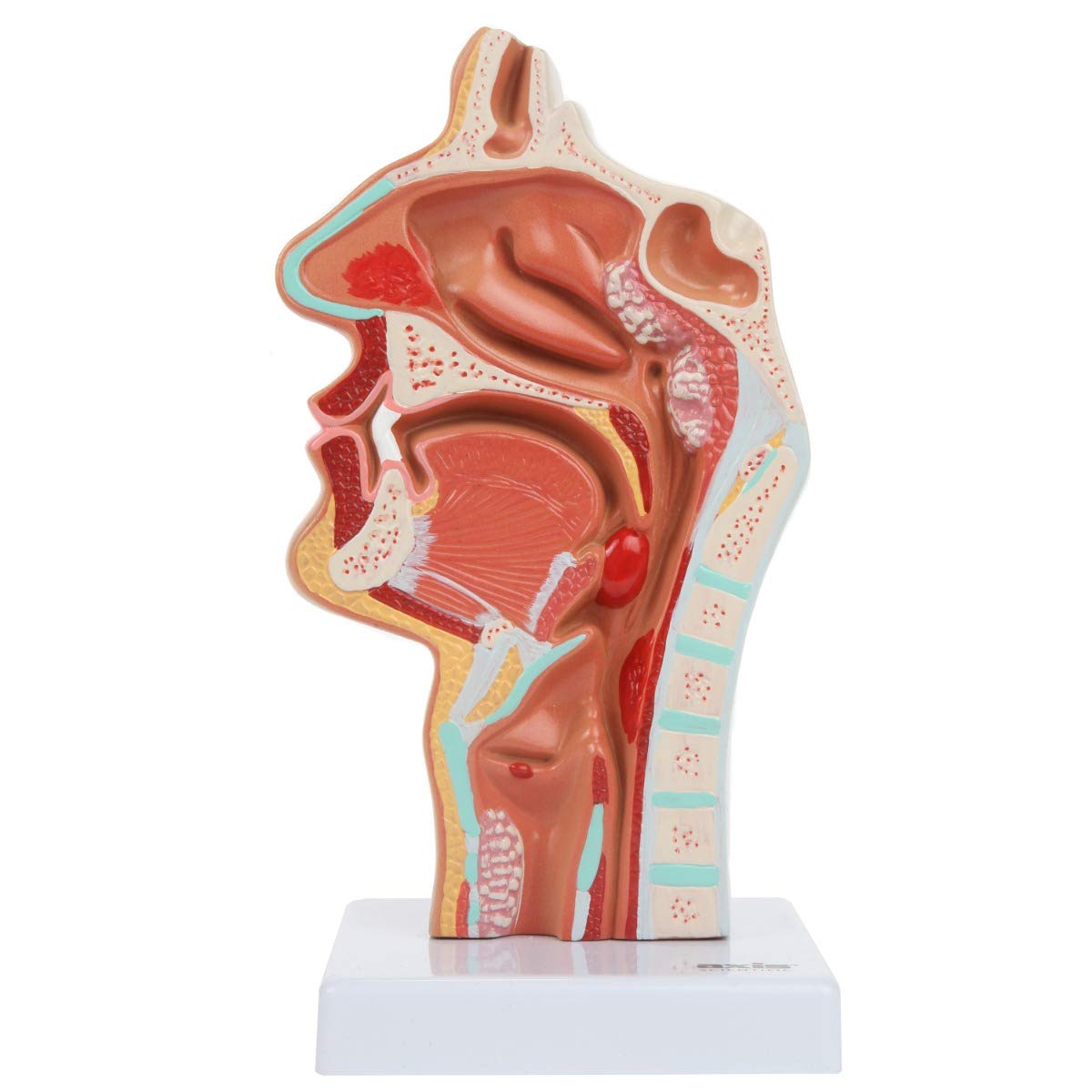 Axis Scientific Human Larynx and Pharynx Disorders Model | Shows Normal Larynx and Pharynx Anatomy and Details Common Abnormalities | Comes on White Base