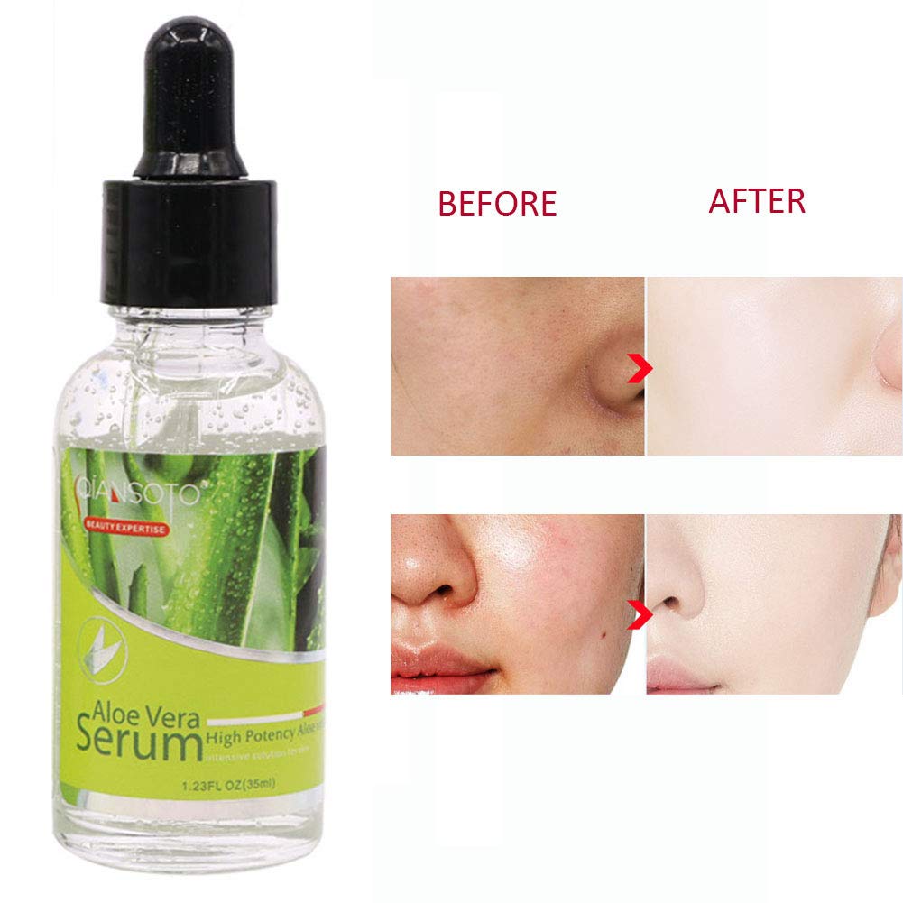 aloe vera serum