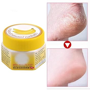 amazon cracked heel cream