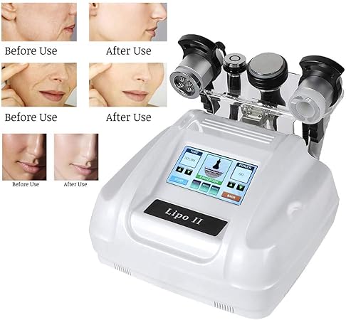 Amazon 40k超音波 多機能 細くする 美機械 ボディセルライト 取り外し 美装置 否定的な圧力 超音波 多重極 100 240v Yuyte 洗顔用フェイスブラシ 通販