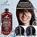 Art Naturals 2 Pack - Scalp18 Coal Tar Therapeutic Anti Dandruff Shampoo 16 oz - Helps clear symptoms of Psoriasis, Eczema, Itchy Scalp & Dandruff - Made in USA with Natural & Organic Ingredients