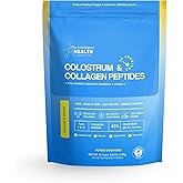 Grass-Fed Colostrum & Collagen Peptides with Probiotics + Vitamin B12 – 800mg IgG for Immune, Gut & Beauty Support – Ethically Sourced, Non-GMO, Hormone-Free, Filler-Free, 30 Servings, 5.11 oz