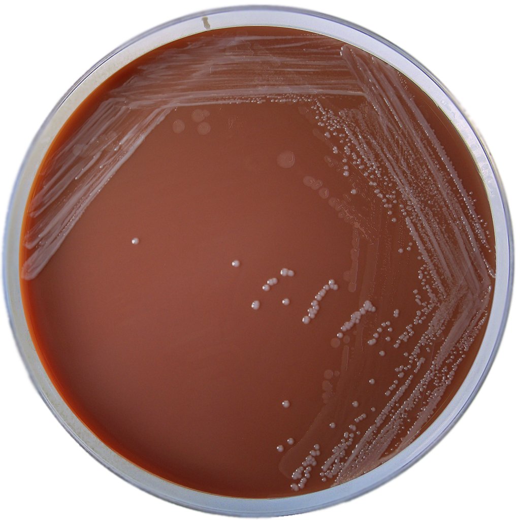 Hardy Diagnostics E14BX Chocolate Agar, (Gc Agar Base with 1 Bovine