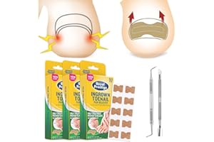 Fertoe Toenail Corrector Patch - 100/200/300Pcs Ingrown Toenail Tool, Ingrown Toe Nail Correction Sticker, Health Toenail Cor