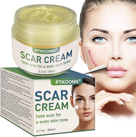 men's acne scar cream