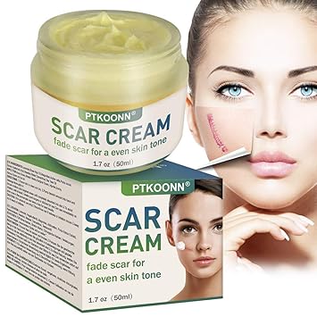 acne scar removal cream amazon