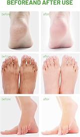 Bexdug Handmade Foot Soap Green Tea Oil for Jock Itch Athlete's Foot Softens view 5