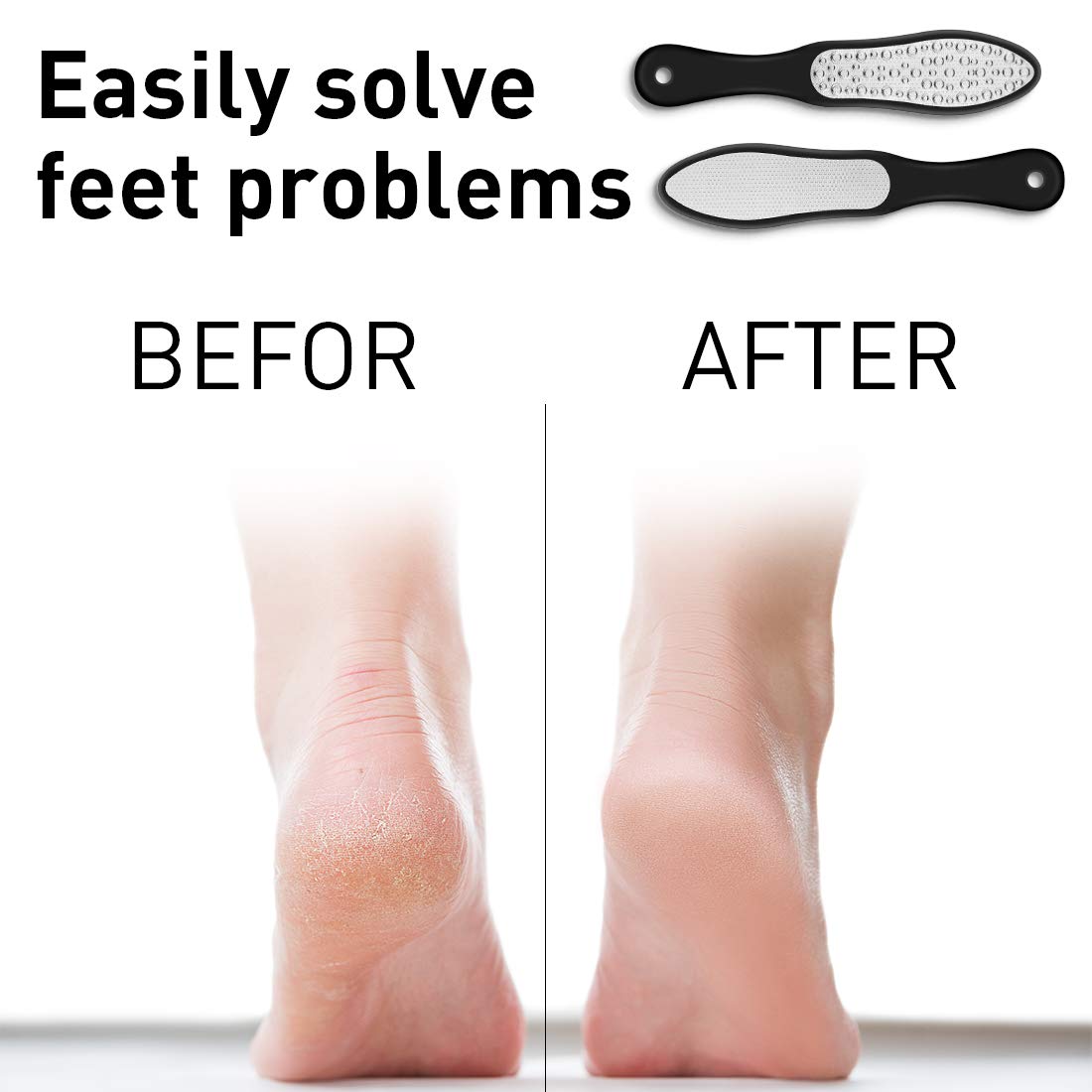 Laser Hornhautfeile - Hornhautentferner für die Entfernung von Hornhaut & Hühneraugen aus rostfreiem Edelstahl - Fußpflege für seidig weiche Füße in Podologie Qualität