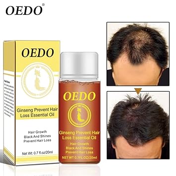 Amazon Com Ginseng Prevent Hair Loss Essential Oil Promote Hair