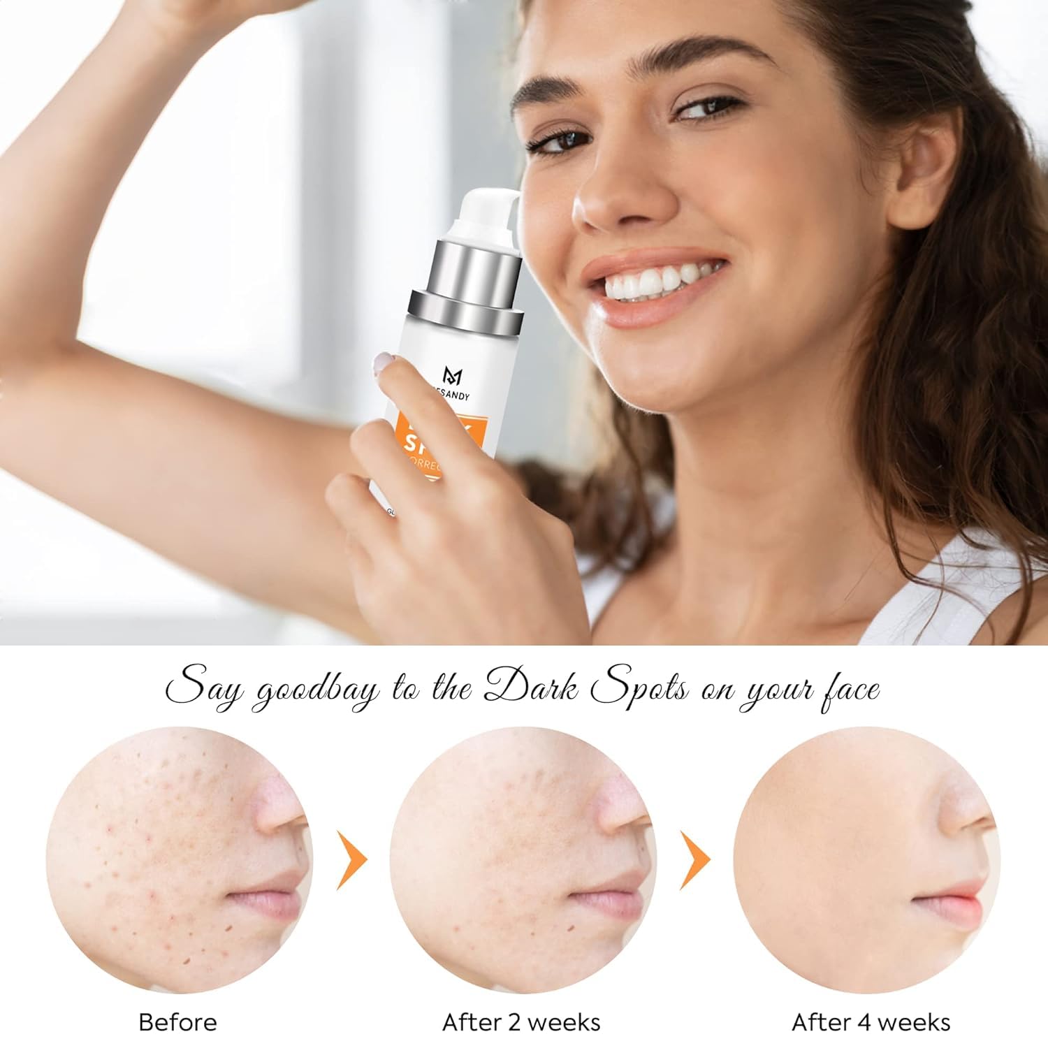 Dark Spot Remover for Face: Dark Spot Correcting Glow Serum with Acid and Niacinamide for Age Acne Melasma Freckle Brown Spots Removal Diminisher- Korean Skin Care Treatment 30ml