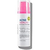 INNBEAUTY Project Acne Serum Medicated Treatment, 1 oz (30 ml) | Targets breakouts, blackheads and excess oil