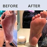 Marble Hill PediSalve Foot Cream 100g Dry Cracked Heels Diabetic Eczema Vit E view 4
