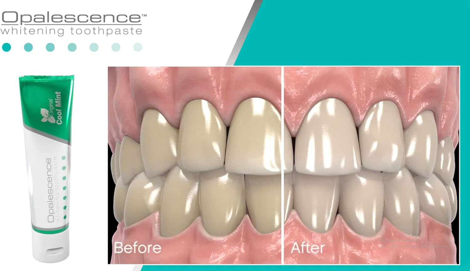 Opalescence Whitening Toothpaste Cool Mint with Fluoride 100ml, 100 ml (Pack of 1) - Image 3