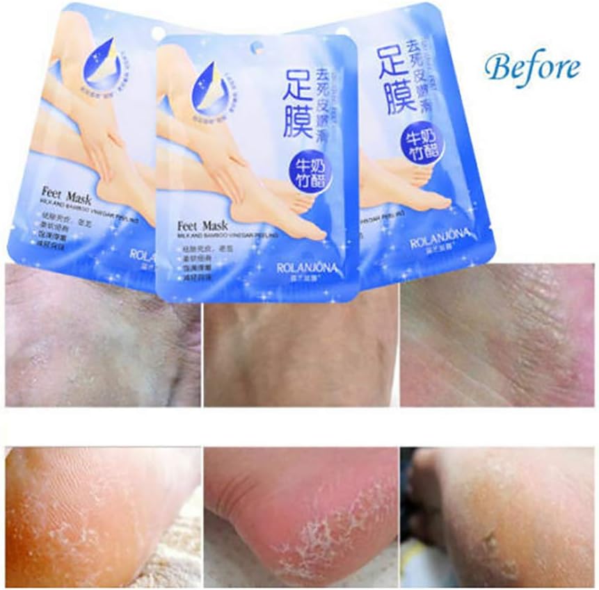 Ardisle Exfoliating Foot Mask Peel Socks 2 Pair - Soft Dead Skin Callus Remover