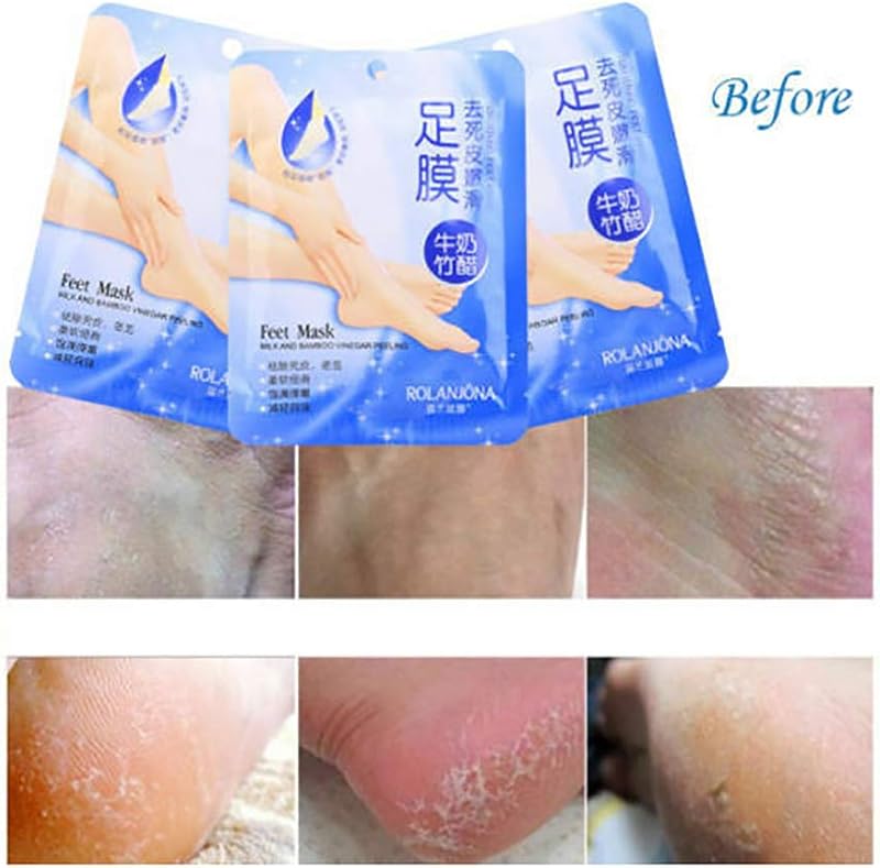 Ardisle Exfoliating Foot Mask Peel Socks 2 Pair - Soft Dead Skin Callus Remover