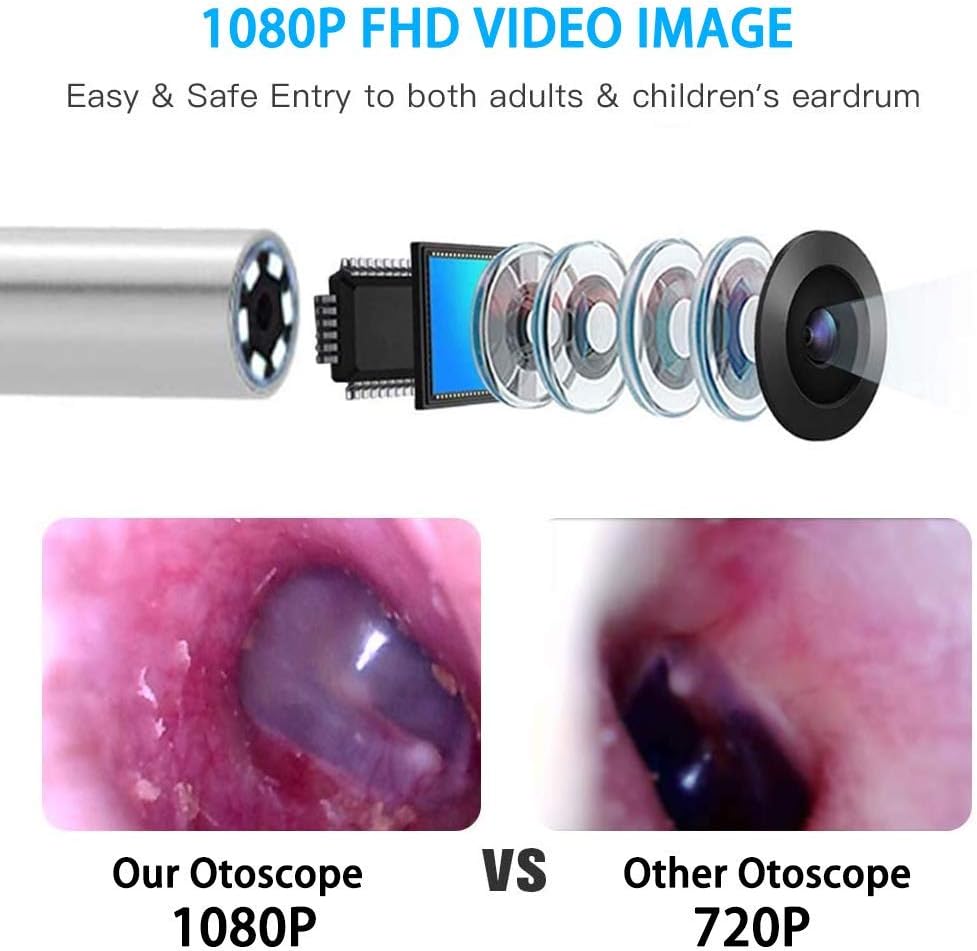 BEBIRD Ear Wax Removal Endoscope Otoscope, Earwax Remover Tools, Scope, with 1080P FHD Camera, 6 Led Lights, Wireless Connected, Compatible with iPhone, iPad, Android Smart Phones & Tablets (White) : Electronics