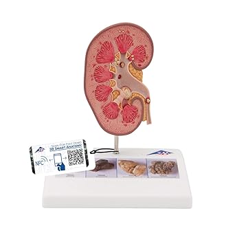 Amazon Com 3b Scientific K29 Kidney Stone Model 3b Smart Anatomy Industrial Scientific