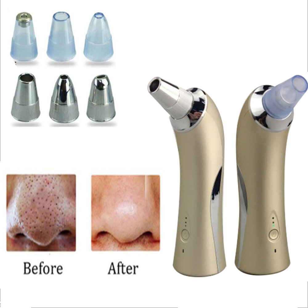 Vinmax Blackhead Suction Remover Portable Skin Peeling Pores Cleaning Blackheads Acne Remover Beauty Machine - Diamond Microdermabrasion Lift Skin Care Device