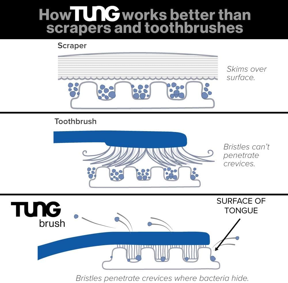 The Original TUNG Brush - 2 Pack - Tongue Cleaner (Colors Vary) : Tongue Cleaners : Health & Personal Care
