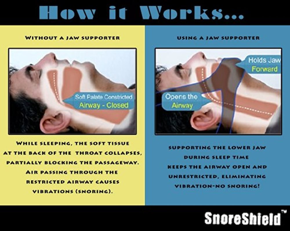 SnoreShield™ Adjustable Anti Snoring Chin Strap – Snore Stopper Sleep Aid – Instant Stop Snoring Solution - Natural Snore Relief : Beauty