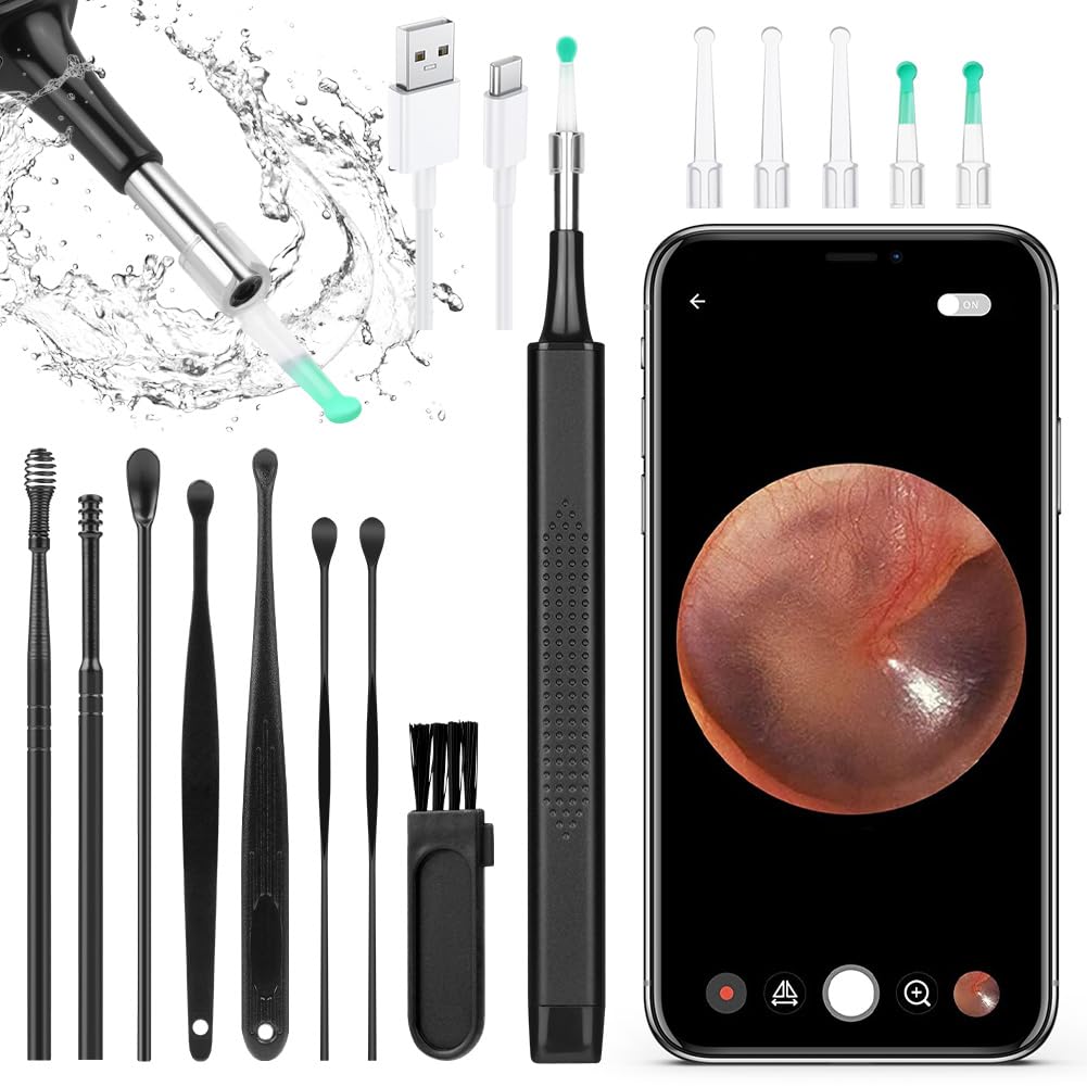 ACWOO Ear Otoscopes, 5040P HD Wireless Ear Wax Removal Kit with Camera, Visual Ear Otoscope Ear Cleaner with 6 LED Lights, Smart Ear Wax Cleaner Tool for Adults, Kids & Pets