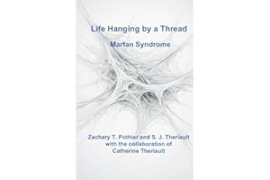 Life Hanging by a Thread: Marfan Syndrome
