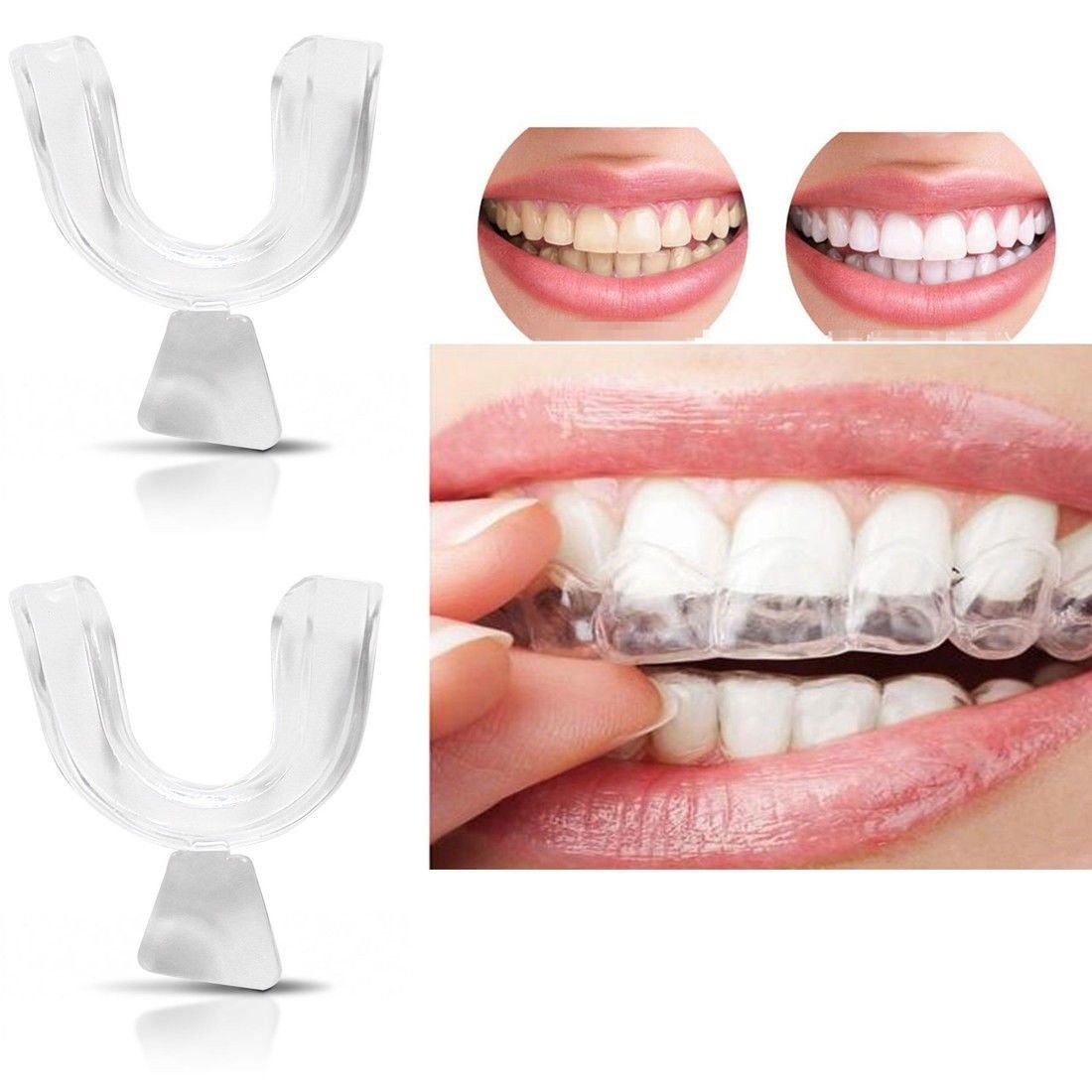 Soft Mouth Guard For Teeth Grinding TeethWalls