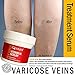 Vitamin K Cream 3.4 oz | High Quality Formula for Bruises, Spider Veins, Dark Circles, Broken Capillaries, Eyes, Face, Legs